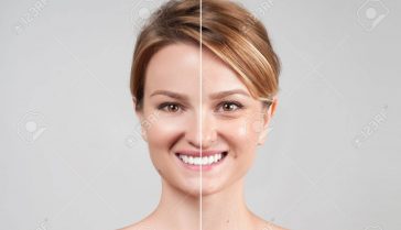 Concept of skin rejuvenation. Woman before and after cosmetic or plastic procedure, anti-age therapy